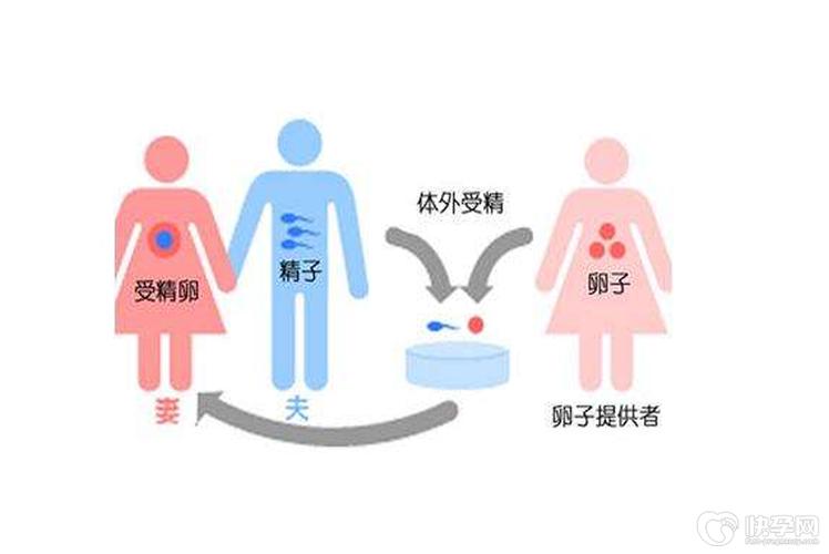 供卵试管代怀方法(供卵试管代怀:新生育方法解析)