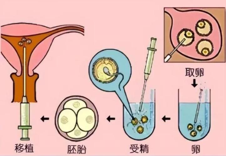 供卵试管哪里做得好(供卵试管哪里做得好?选择最佳的试管供卵中心)