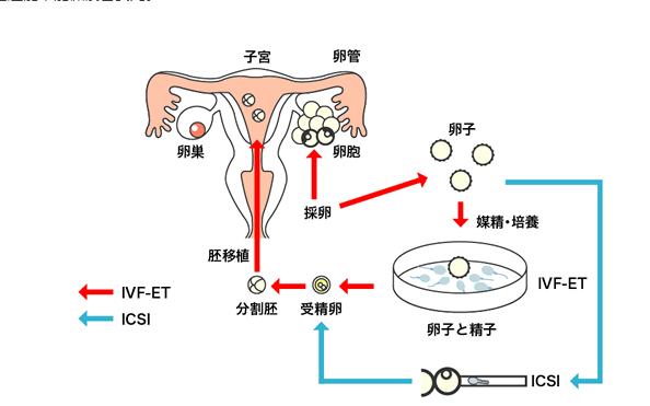 试管供卵是什么意思-试管供卵是什么意思及其影响分析